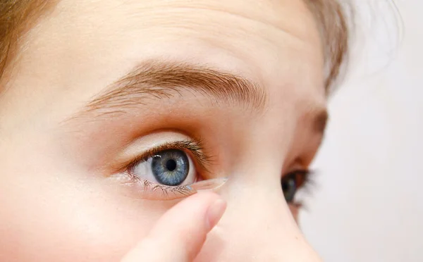 Little Girl Child Putting Contact Lens Her Eye Closeup Vision — Stock Photo, Image