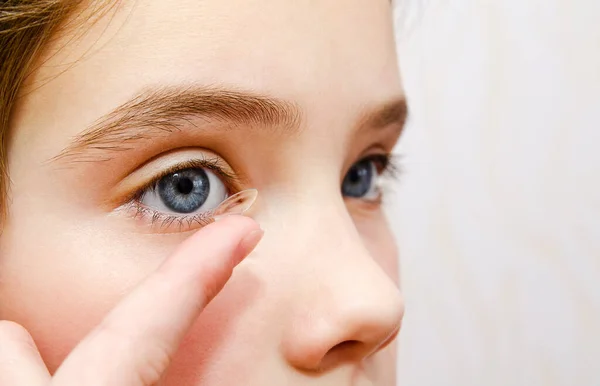 Little Girl Child Putting Contact Lens Her Eye Closeup Vision — Stock Photo, Image