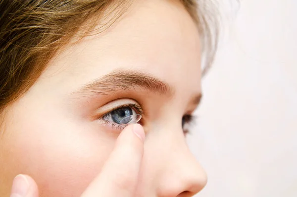 Little Girl Child Putting Contact Lens Her Eye Closeup Vision — Stock Photo, Image
