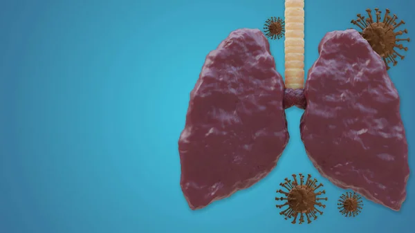 Coronavirus 2019 salgını tarafından saldırıya uğrayan akciğer (covid19), arka planda bir koronavirüs bulunmaktadır..