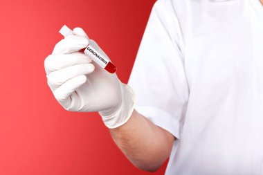 Koruyucu eldivenli doktor elinde Coronavirus kan örneğiyle test tüpü tutuyor. Grip hastalığını önle Coronavirus