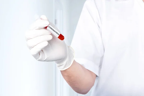 保護手袋の医者の男は コロナウイルスの血液サンプルと試験管を保持しています インフルエンザの予防 コロナウイルス — ストック写真