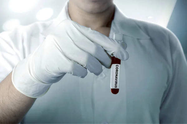 Doctor Man Protective Gloves Holding Test Tube Coronavirus Blood Sample — Stock Photo, Image