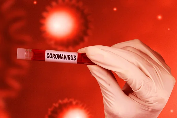Medico Guanti Protettivi Con Una Provetta Con Campione Sangue Coronavirus — Foto Stock