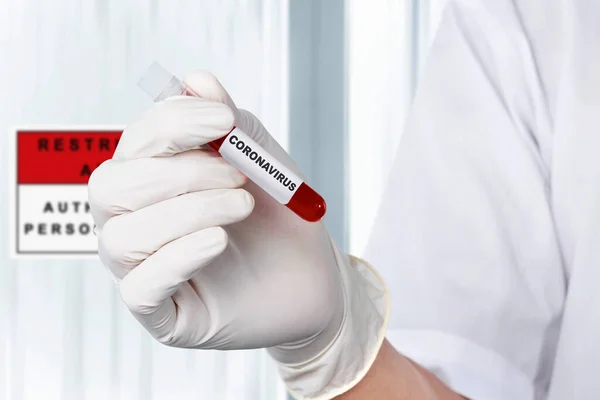 Arzt Schutzhandschuhen Hält Ein Reagenzglas Mit Einer Coronavirus Blutprobe Der — Stockfoto