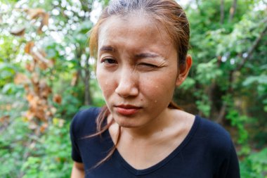 Kadın yüzü terliyor..