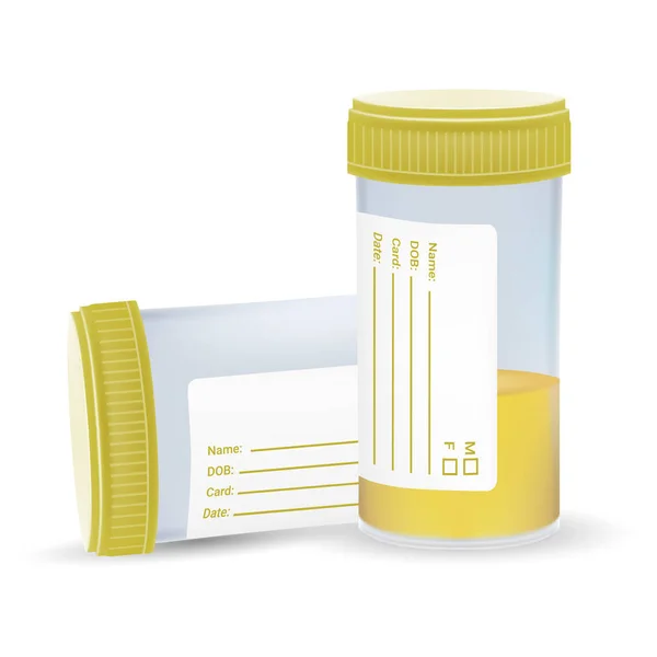 Urine Test In A Plastic Jar Isolated On A White Background. Realistic Vector Illustration. — Stock Vector