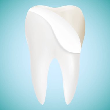 Bir arka plan üzerinde izole diş kaplama beyazlatma diş teknisyeni vektör bir kavram. Gerçekçi vektör çizim.