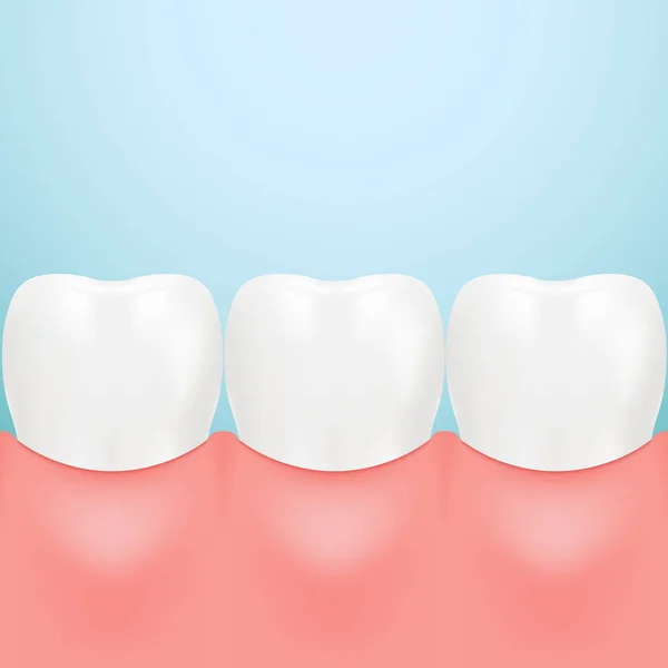 Dente di cura dentale isolato su uno sfondo. Illustrazione vettoriale realistica . — Vettoriale Stock