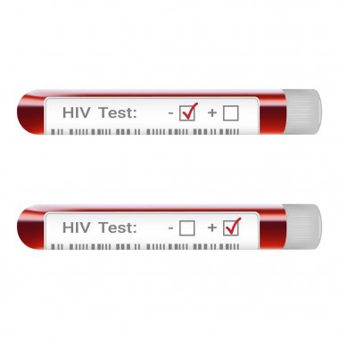 HIV testi sonucu kavramı ile kan toplama tüp gösteren HIV pozitif ve negatif Test sonuçları beyaz bir arka plan üzerinde izole eleme. Gerçekçi vektör çizim.