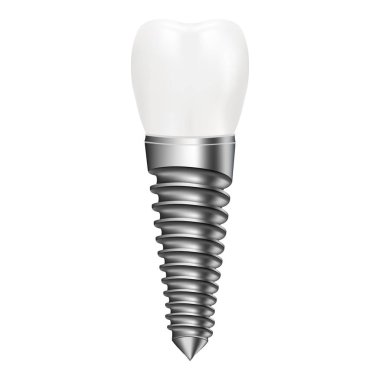 Implant diş beyaz bir arka plan üzerinde izole. Vektör çizim.