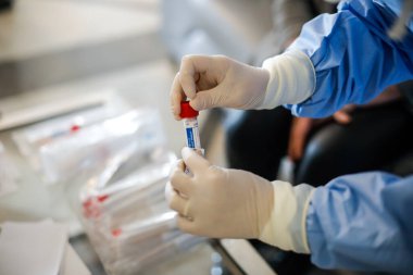 Bükreş, Romanya - 13 Mart 2020: Bir kişi üzerinde koronavirüs testi uygulayan bir sıhhiyenin elleriyle ayrıntılar.