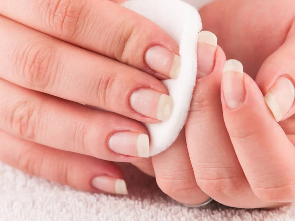 Vrouw met behulp van nagel remover — Stockfoto