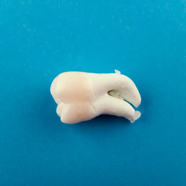 Ayıklanan üçüncü molar mavi backgroud çürümeyle olmadan — Stok fotoğraf