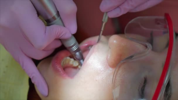 Mulher Dentista Tratando Dentes à Mulher Paciente na Clínica. Médica Estomatologista Profissional Feminina no Trabalho. Conceito Dental Check Up. — Vídeo de Stock