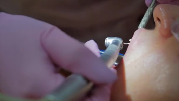 Tandarts trakteert vrouwen op een patiënt in de kliniek. Vrouwelijke professionele dokter Stomatoloog op het werk. Concept Tandheelkundige controle. — Stockvideo