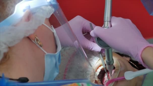 Dentista donna che cura denti a paziente donna in clinica. Igiene orale con una soluzione speciale, pulizia della cavità orale con ultra suono. Medico dentista professionista di sesso femminile al lavoro. Esame dentale — Video Stock