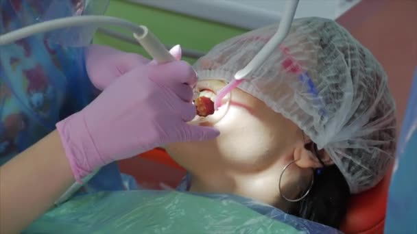 Dentystka lecząca zęby pacjentce w klinice. Higiena jamy ustnej ze specjalnym roztworem, czyszczenie jamy ustnej ultradźwiękiem. Lekarz dentysta w pracy. Badanie stomatologiczne — Wideo stockowe