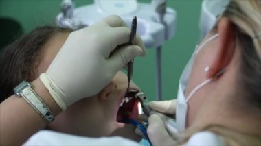 Kadın Diş Hekimi Çocuktaki Bebek Dişlerini Tedavi Ediyor. Resepsiyondaki Küçük Kız Diş Hekiminde Bir Sandalyede Oturuyor. Bir Kadın Profesyonel Diş Hekimi Çocuk Dişlerini Kontrol Ediyor ve Tedavi Ediyor. Diş muayenesi.