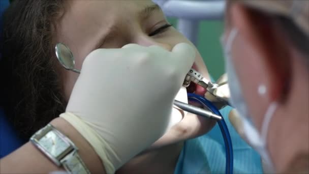 Dentista femminile tratta i denti del bambino in un bambino. Bambina si siede in una sedia dal medico dentista alla reception.A Dentista professionista femminile esamina e tratta un bambino denti. Esame dentale . — Video Stock