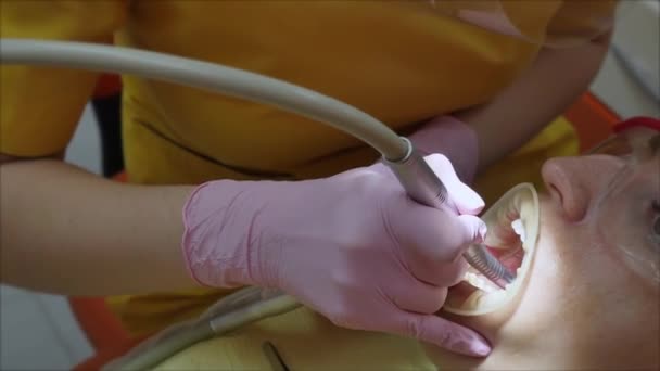 Fermer Femmes mains Médecin stomatologue professionnel au travail. Une personne subit un examen médical et un traitement de la cavité buccale chez le dentiste . — Video