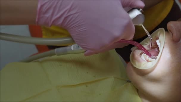 Fermer Femmes mains Médecin stomatologue professionnel au travail. Une personne subit un examen médical et un traitement de la cavité buccale chez le dentiste . — Video