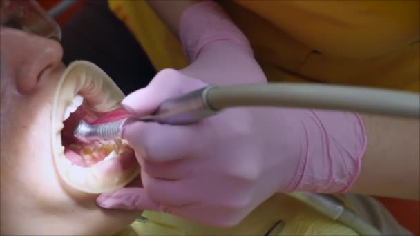Dentist treating teeth to woman patient in clinic. — Stock Video