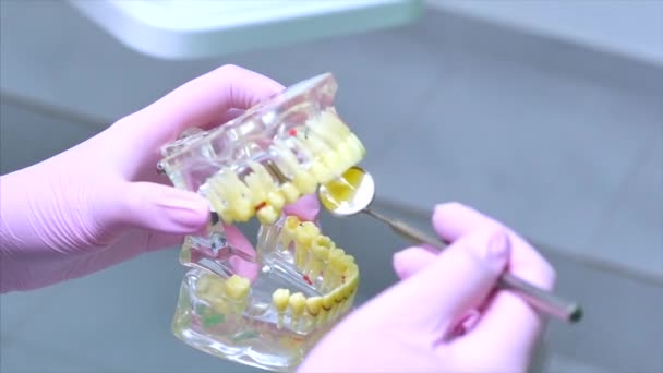 Mujer Dentista Tratando Dientes a Mujer Paciente en Clínica.Dentista muestra al paciente en el modelo de la mandíbula cómo tratar adecuadamente sus dientes, da lecciones sobre el cuidado adecuado de los dientes y la cavidad oral — Vídeos de Stock