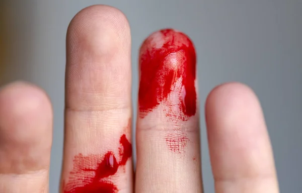 Dedo herido, brazo con sangre, sangrado —  Fotos de Stock