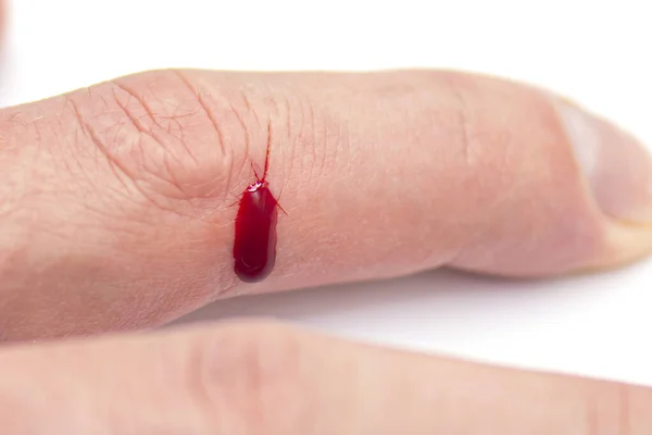 Närbild Finger Med Naturligt Sår Och Droppe Blod Skadad Finger — Stockfoto