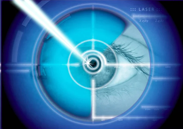 Chirurgia laser oculare, correzione laser, correzioni oculari — Foto Stock