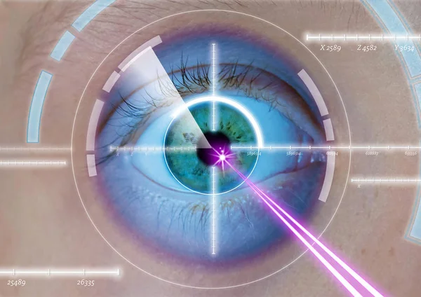 eye laser surgery,  laser correction, eyes corrections