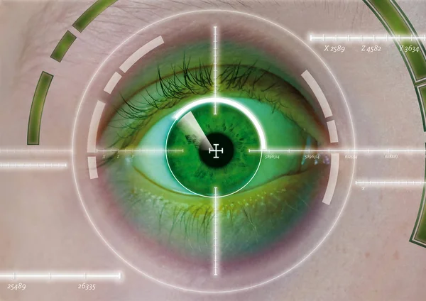 Cirurgia a laser ocular, correção a laser, correções oculares — Fotografia de Stock