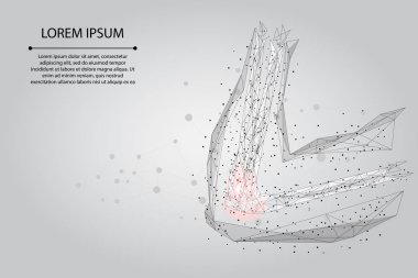 Soyut karışım hattı ve poin insan kolu eklemi. Düşük polimer dizayn dirsek tedavisi acı tedavi vektörü çizimi