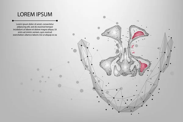 Línea Malla Abstracta Punto Sinusitis Baja Poliomielitis Seno Nasal Sano — Vector de stock