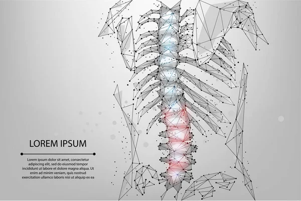 Abstract mesh line and dot physiotherapy human spine. Low poly Pain area surgery operation. Polygonal render female back hernia vector illustration — Stock Illustration Abstract Mesh Line Dot Physiotherapy Human Spine Low Poly Pain Stock Vector