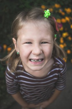 Diş hekimi olan ve tek dişi olmayan bir çocuk.