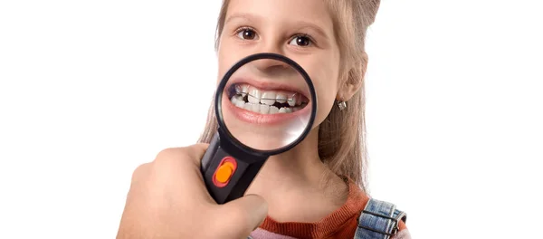 Malá roztomilá dívka s ortodontický spotřebič na bílém backgr — Stock fotografie