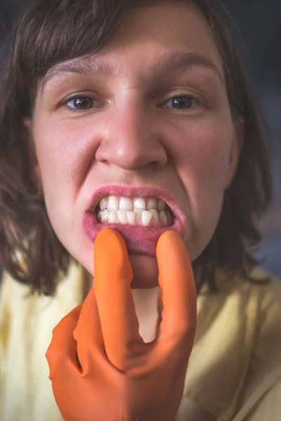 Woman Gloves Shows Her Crooked Teeth — Stock Photo, Image