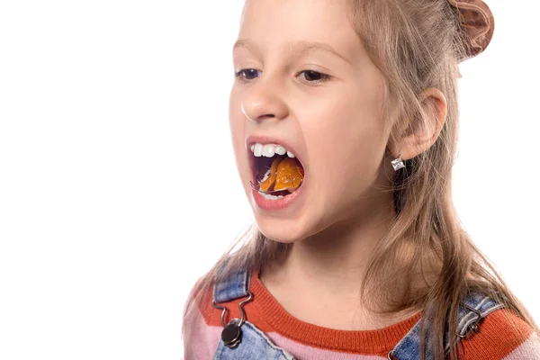 Portret Dziewczynki Pokazuje Jej Urządzenie Ortodontyczne Białym Tle — Zdjęcie stockowe