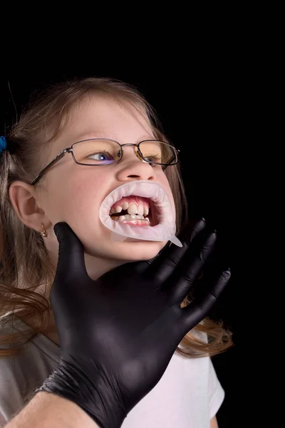 医者は子供の歯を調べる 曲がった歯を持つ子供 黒い背景のスタジオ写真 — ストック写真