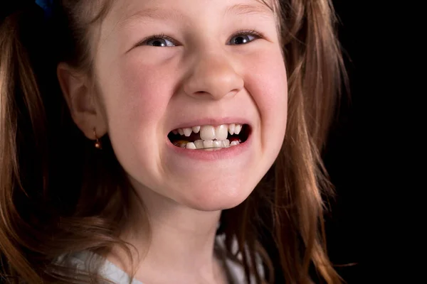 Маленька Дівчинка Показує Криві Зуби Чорному Тлі Студійне Фото — стокове фото