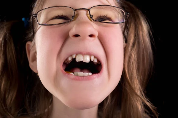 Niña Muestra Los Dientes Torcidos Sobre Fondo Negro Estudio Foto —  Fotos de Stock