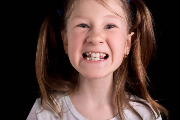 Petite Fille Montre Des Dents Tordues Sur Fond Noir Studio — Photo