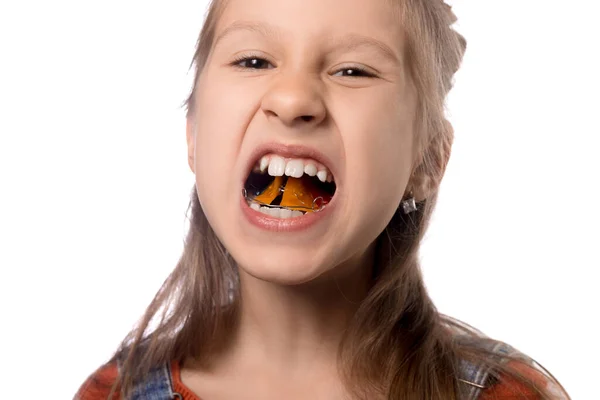 Portret Dziewczynki Pokazuje Jej Urządzenie Ortodontyczne Białym Tle — Zdjęcie stockowe