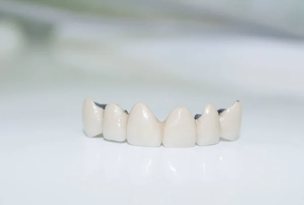A dental prosthesis on a light background — Stock Photo, Image