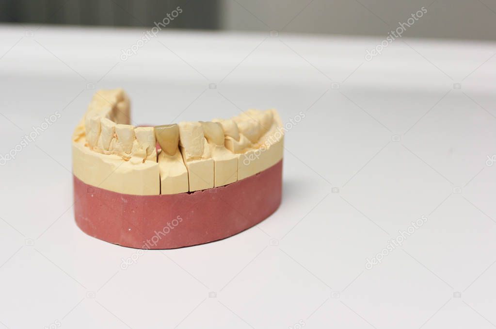 the diagnostic model of the dentition