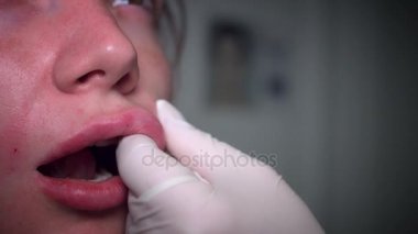 4k yakın çekim nazolabial dolgu yordamı