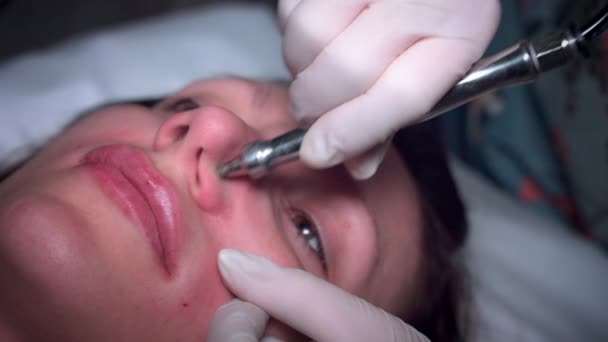 Rosto de mulher 4K com microdermoabrasão no nariz — Vídeo de Stock