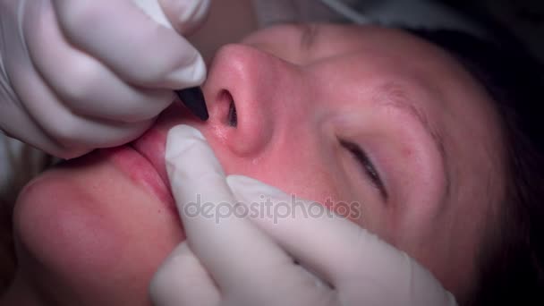 Tratamientos de diatermia de vena facial de mujer 4K — Vídeos de Stock